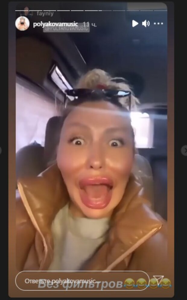 Оля Полякова перестаралась с пластикой и увеличением губ - today.ua