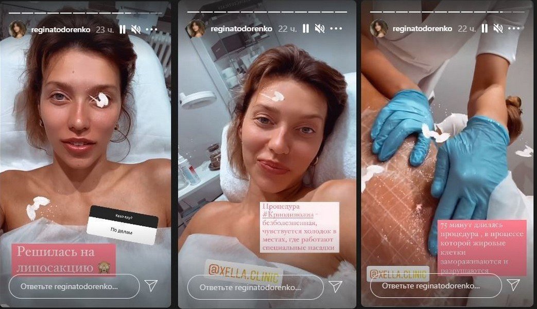 Регіна Тодоренко зважилася на ліпосакцію і показала фото з операційної