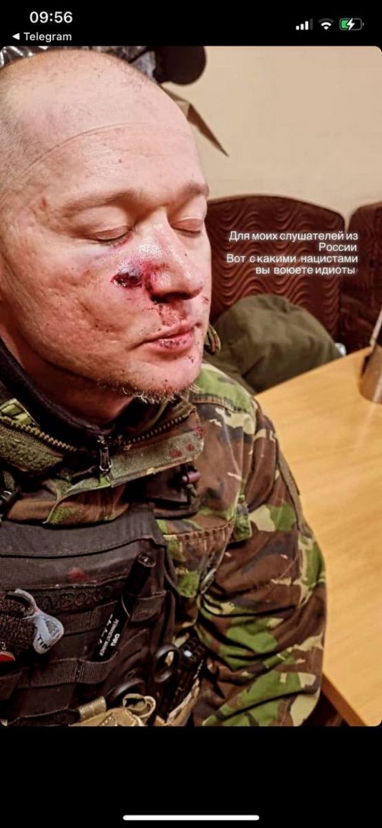 Лидер “Бумбокса“ Андрей Хлывнюк попал под минометный обстрел и получил ранения