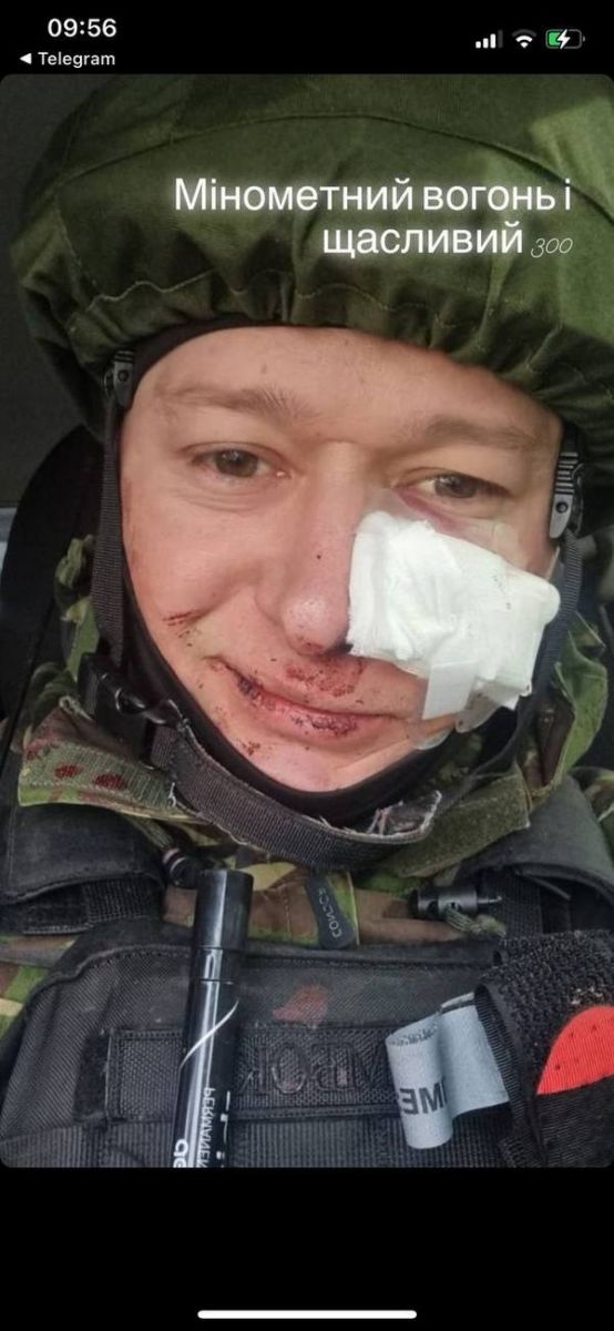 Лидер “Бумбокса“ Андрей Хлывнюк попал под минометный обстрел и получил ранения