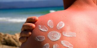 Ніякої сметани: як врятувати шкіру після сонячного опіку влітку - today.ua