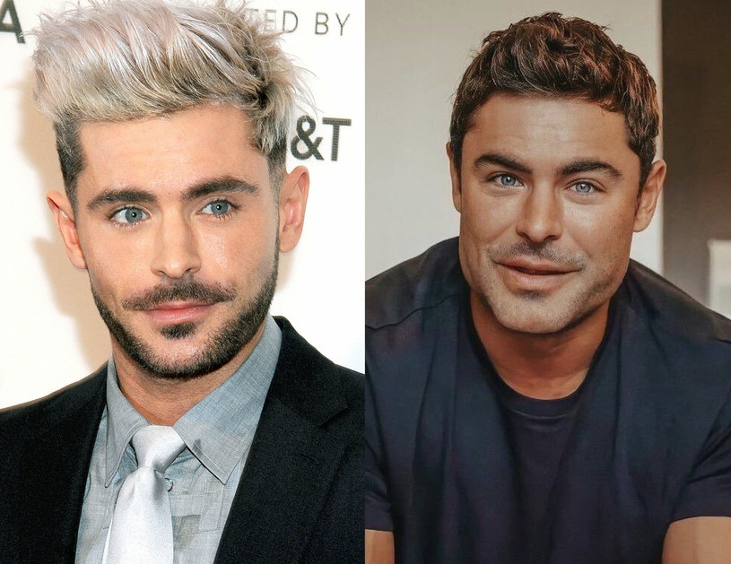 Что у него с лицом?: Зак Эфрон испугал внешним видом после слухов о неудачной пластической операции - today.ua