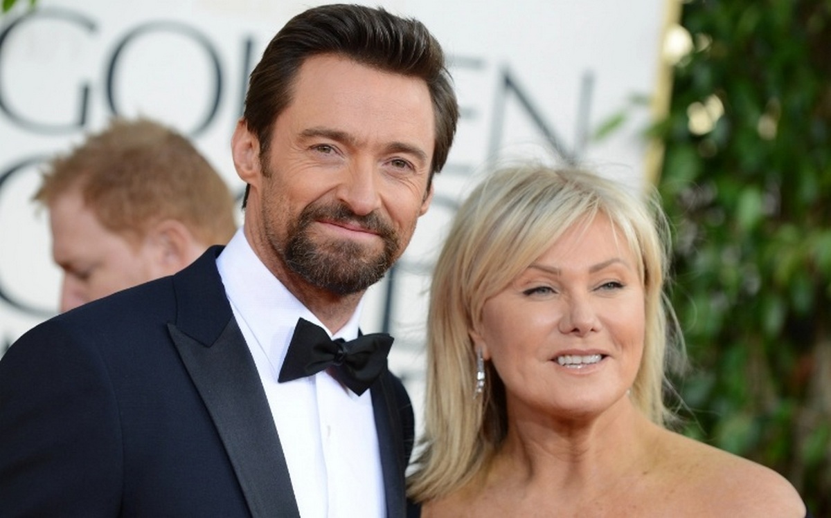 Що на ній надіто?: дружина Г'ю Джекмана насмішила вбрання на Венеціанському кінофестивалі - today.ua