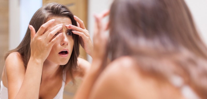 Медики розповіли, про які проблеми зі здоров'ям можуть сигналізувати прищі на обличчі