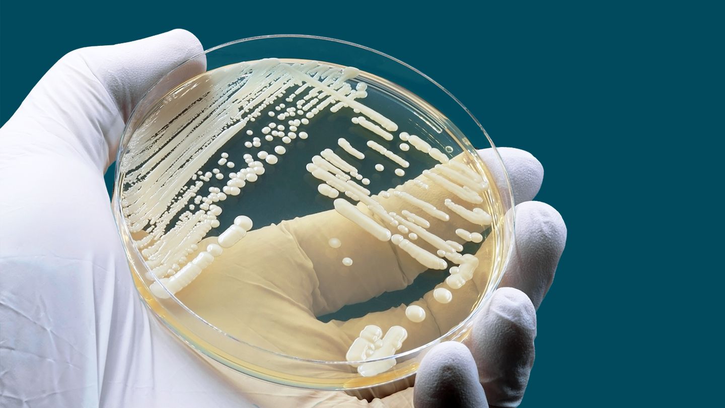 В мире после COVID распространяются смертельные грибковые инфекции - today.ua