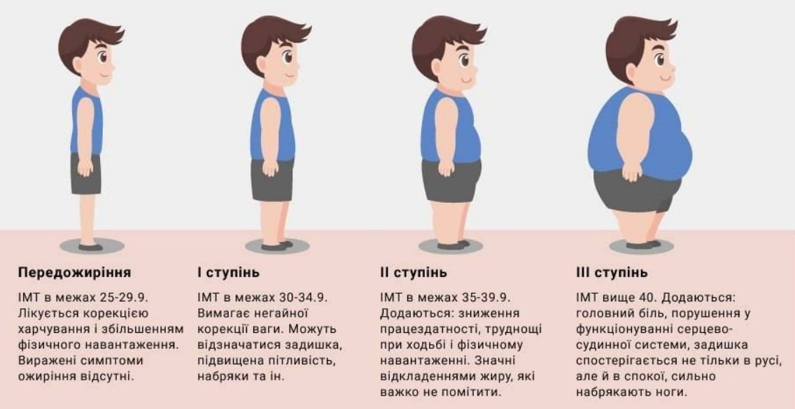 Кожна п'ята дитина в Україні має зайву вагу, - МОЗ